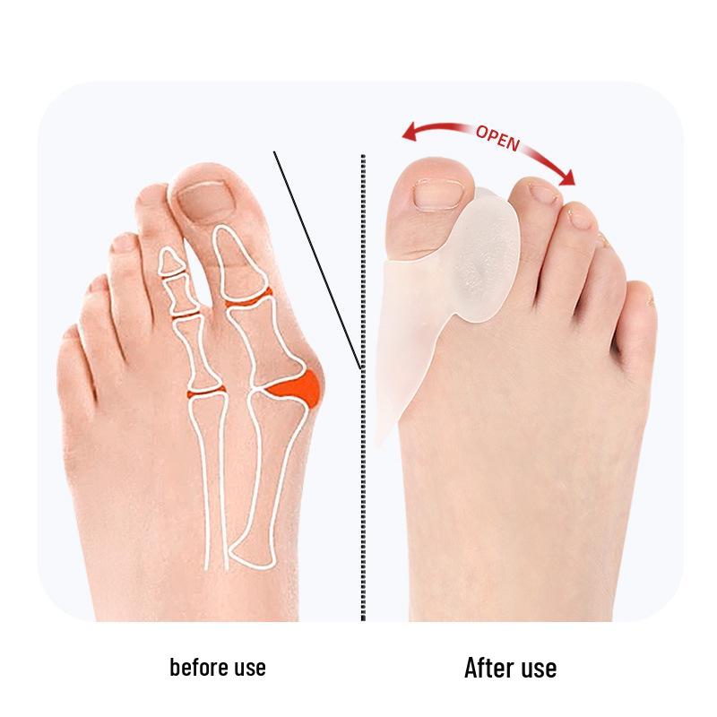 Silicone Bunion Big Toe Separator and Protector Cover