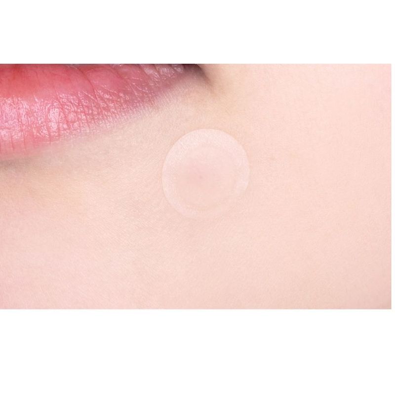 VT - Cica Spot Patch