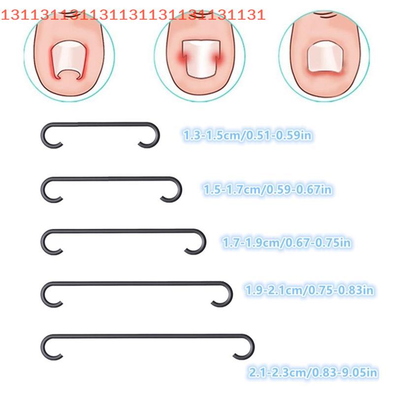Ingrown Toenail Corrector Tools Pedicure Recover Embed Toe Nail Professional Ingrown Toenail Straightening Clip Brace