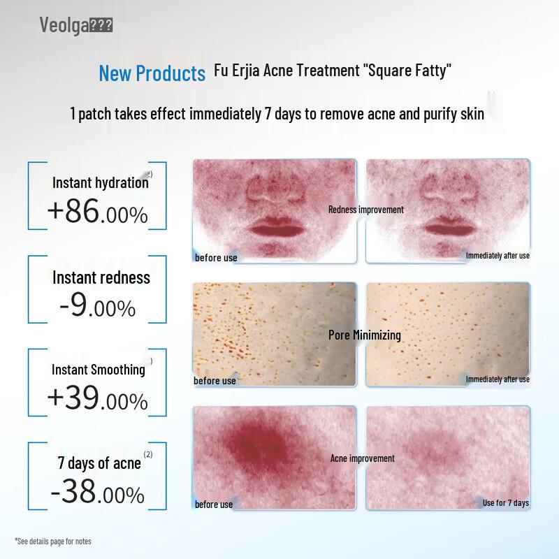 Fuerjia Acne Clearing & Purifying Wet Compress Mask