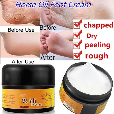 Huile de cheval crème réparatrice pour les mains et les pieds crème de soin pour les pieds béribéri et démangeaisons des pieds ampoules préviennent les gerçures