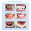10ml Tooth Serum Effective Removing Stain Natural Extract Teeth Whitening Powder Clean Oral Essence