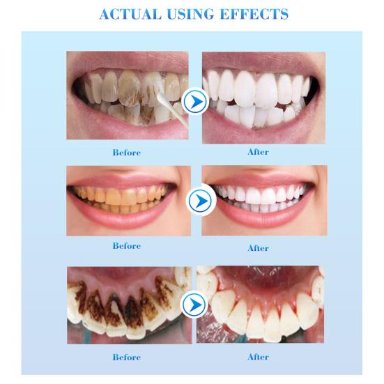 10ml Tooth Serum Effective Removing Stain Natural Extract Teeth Whitening Powder Clean Oral Essence