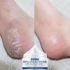Salicylic Acid Urea Foot Moisturizer Brightens Skin Tone, Moisturizes, Lightens Dullness, and Firms Skin