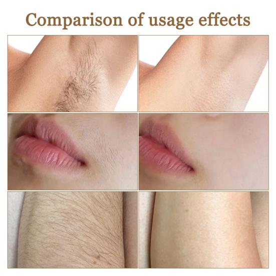Yousheng 1/2 Stück 100ML Kokosöl Gesichtshaarentfernung Creme Pflanzenextrakt Schmerzfrei Feuchtigkeitsspendend Ganzkörper Arm Bein Achseln Haarentferner Depilatory