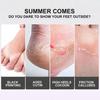 Lavender Exfoliating Foot Mask Dead Skin Removing Foot Peel Fast Exfoliation Long Lasting Moisturizing