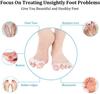 New  Toe Separators to Correct Bunions and Restore Toes to Their Original Shape,Straightener Toe Stretcher Big Toe Correctors