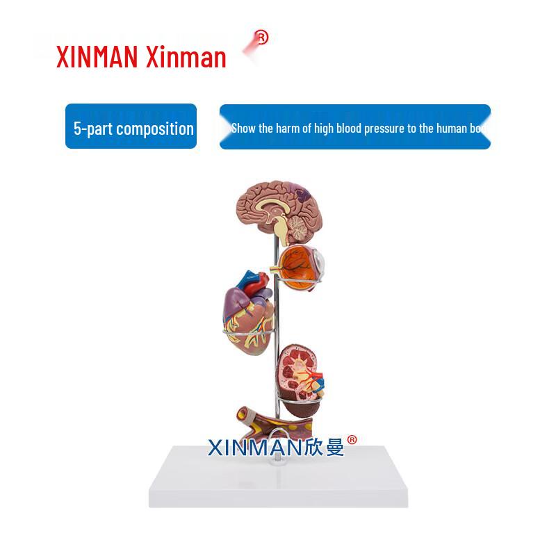 XINMAN Hypertension and Cardiovascular Disease Teaching Model