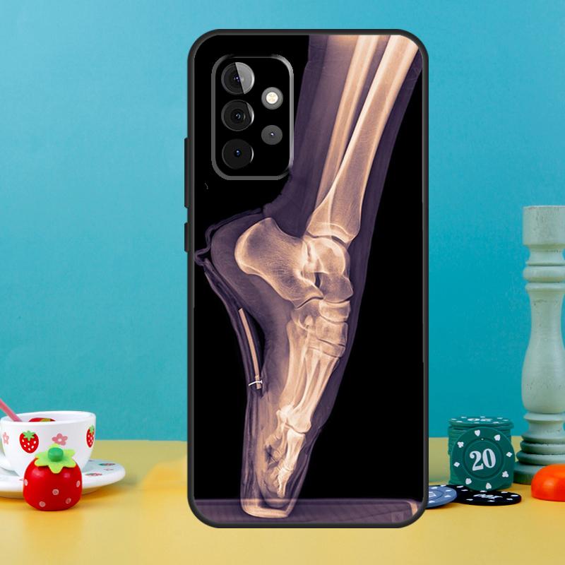 

X-Ray Human Anatomy Case For Samsung Galaxy A14 A24 A34 A54 A12 A22 A32 A52 S A13 A33 A53 A51 A71 Phone Cover Samsung A14