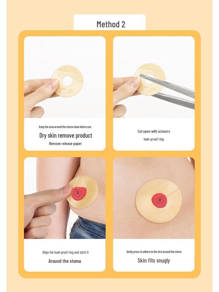 Anneau adhésif moulable étanche pour les soins de stomie - Plaque de base pour accessoire de colostomie