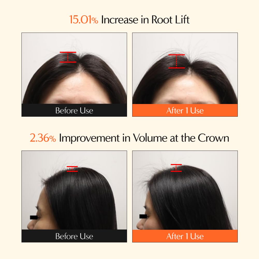 Lilyeve Grow:TURN 3D Volume Anti-Hair Loss Shampoo – 200 ml (Brush Applicator)