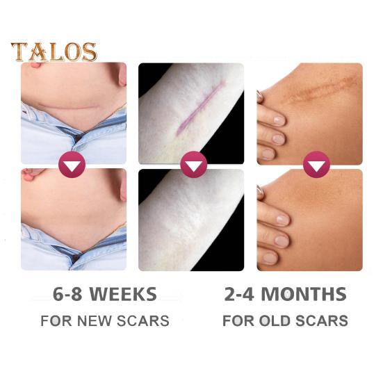 Silikon ärrarkblad Ärrtejp Rulle Professionella Mjuka Ärrremsor för Kirurgiska Ärr Keloider Akneärrbehandling Silikongelplåster