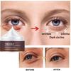 Temporary Eye Bags Removal Cream Instant Under Eye Firming And Tightening Eye Cream Lifts And Firms Eye Skin For Dark Circles