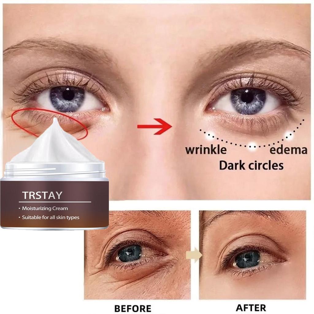 Temporary Eye Bags Removal Cream Instant Under Eye Firming And Tightening Eye Cream Lifts And Firms Eye Skin For Dark Circles