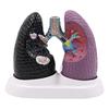 Anatomical Pathological Lung Model Human Lung Anatomy Model Normal and Pathological Lung Anatomy Model for Teaching Tool