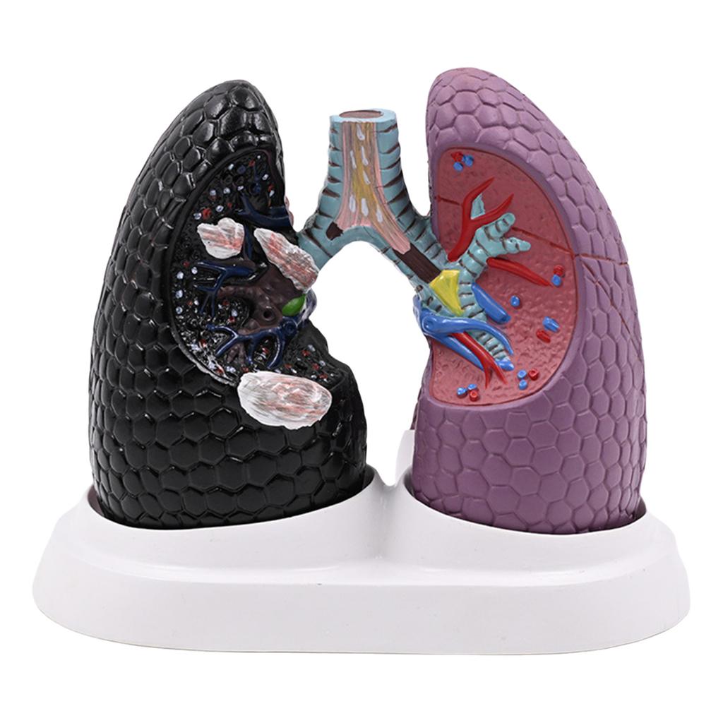 Anatomical Pathological Lung Model Human Lung Anatomy Model Normal and Pathological Lung Anatomy Model for Teaching Tool