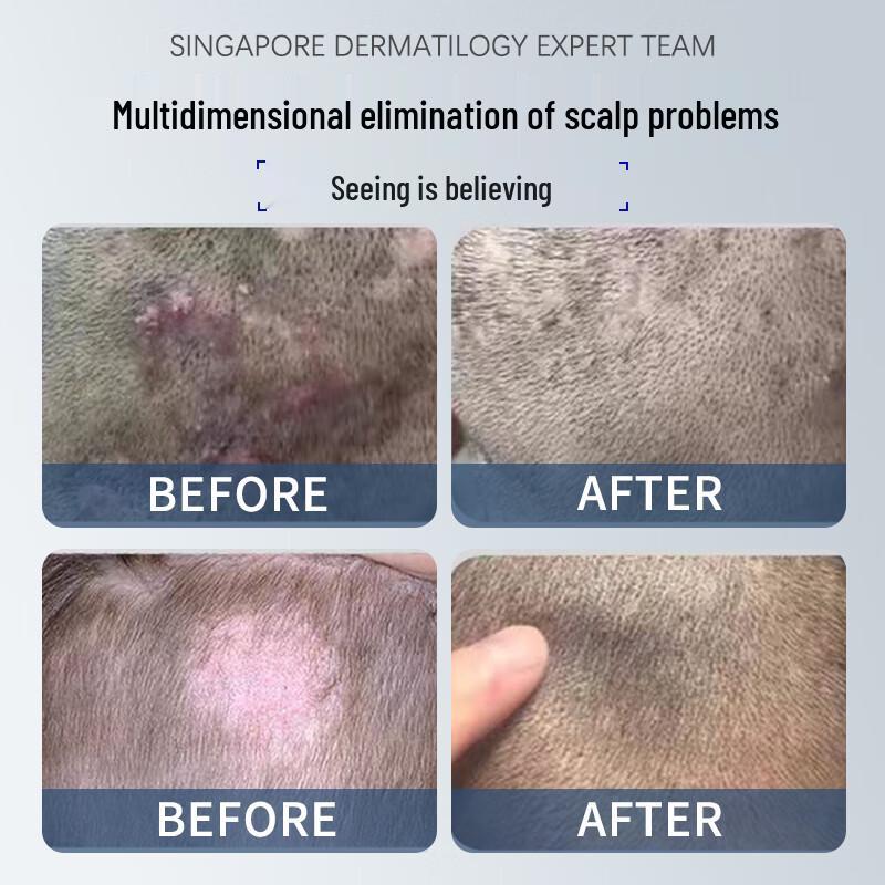 BEAI Professional Hair Care Series