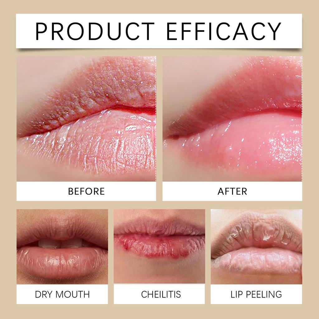 Jaysuing Lip Essence Serum Hydrating Moisturizing Nourishing Softening Lip Care 15ml