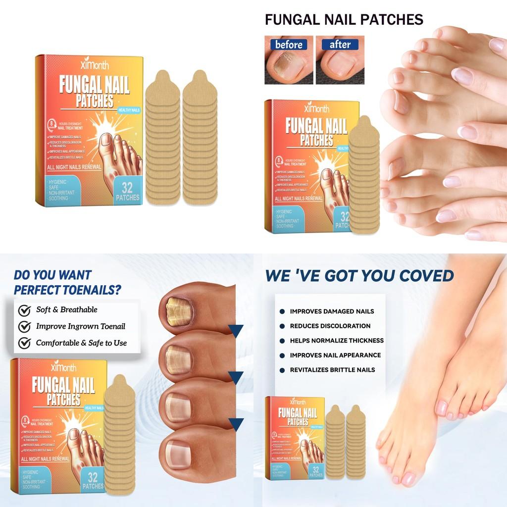Ximonth Toenail Care Repair Patches For Repairing Protecting And Moisturizing Damaged Nails 32 Pcs