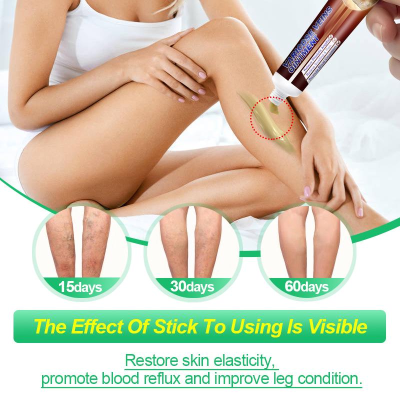 KanyeHB Maikang Vein & Vasculitis Cream