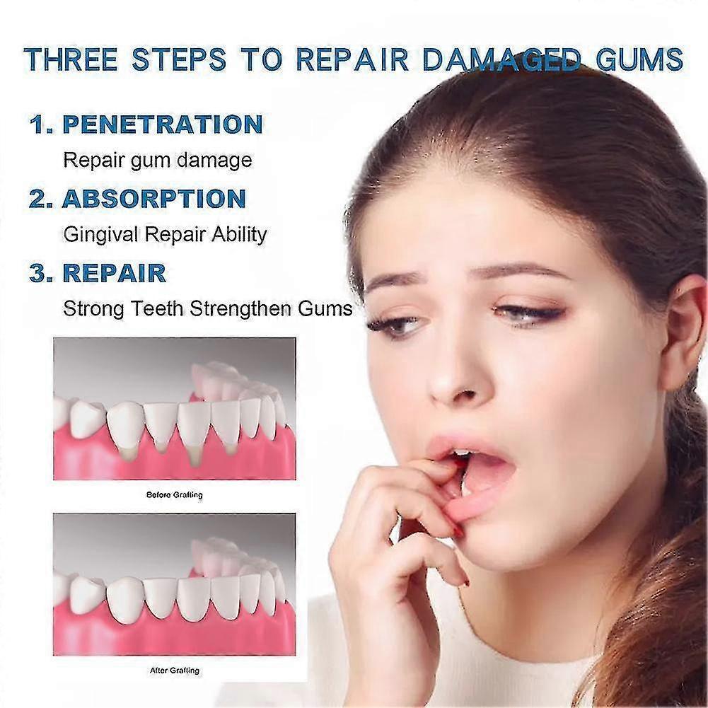 1-3X Gum Restore Plus - Ústní kapky na zuby, zápach z úst, regeneraci dásní 30ML