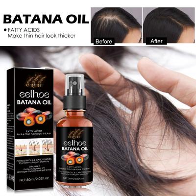 Cura di capelli e cuoio capelluto – Rimedi per la caduta dei capelli