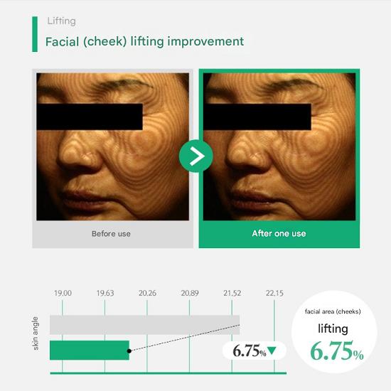 LIRI PDRN Liposome 14 Ampoule 50ml