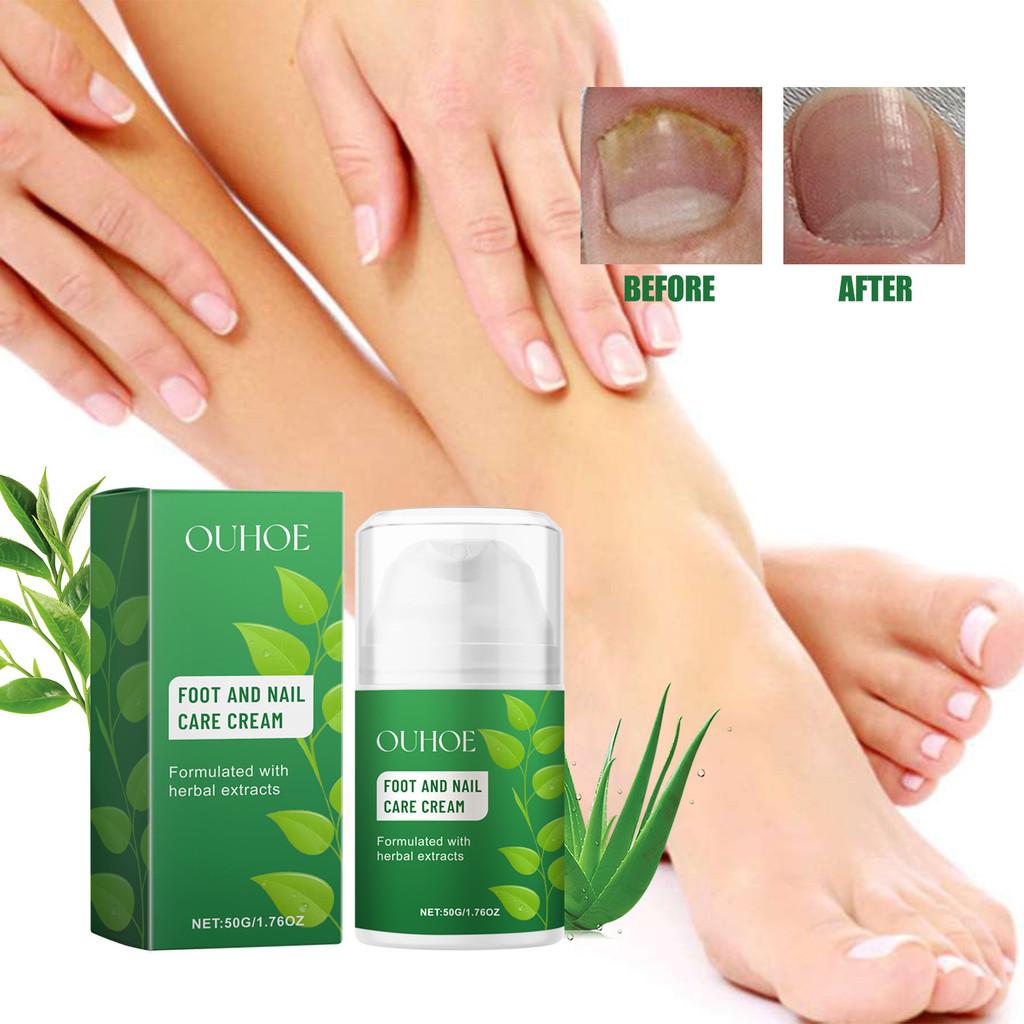 Ouhoe Nourishing Foot And Nail Care Cream For Soft Moisturized Healthy Feet