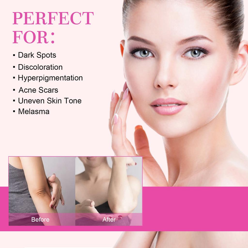 Skin Care Cream That Moisturizes, Moisturizes, Rejuvenates, and Whitens The Skin, Reducing Melanin In The Body Lotion