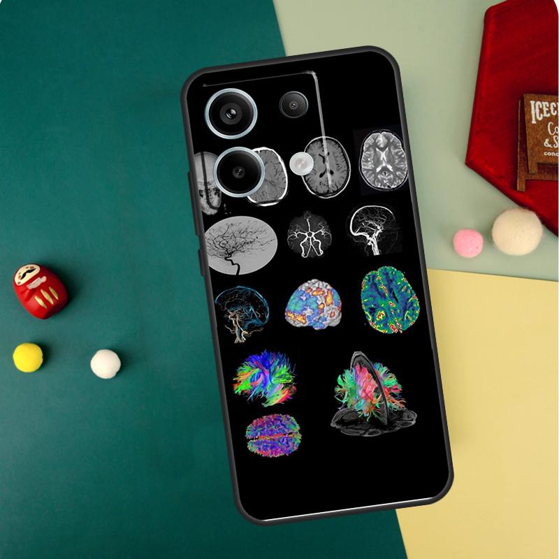Anatomy Brain Case For Xiaomi Redmi Note 13 14 12 11 10 15 Pro Plus Redmi 13 15 14C 13C 15C 10C 12C Funda