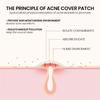 1 box Acne Patches Party Stickers Heart Star Decals Halloween Pimple Patch