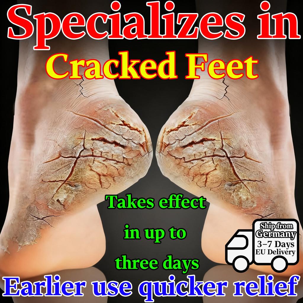 Fast Relief Serum for Dry & Cracked Hands Feet - Herbal & Gentle