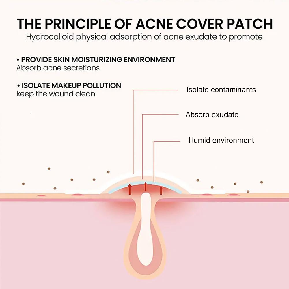 200Pcs Acne Patches Fade Blemishes Pimple Marks Closed Acne Blemishes Hydrocolloid Star Heart Shaped Cover Acne Pimple Patch