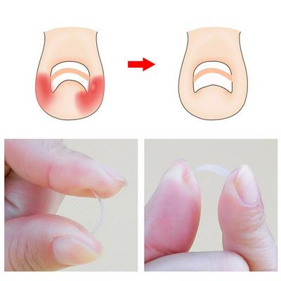 10-50pcs Ingrown Toenail Correction Tool Ingrown Toe Nail Treatment Elastic Patch Sticker Straightening Clip Brace Pedicure Tool