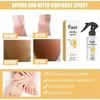 Foot Peeling Spray for Dry Cracked Feet,Instant Exfoliating Foot Spray with Orange Oil,Gentle Foot Peel Mask for Dead Skin Removal Nourishing