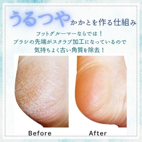 Sunpack Official Foot Groomer Grand (Star White) - Reward Your Heels with Moisturizing and Shining Heels, Prevents Dryness and Coldness, Exfoliates an