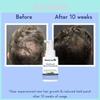 B3014 Hair Growth Concentrate Serum For Home Use With Luxurious Packaging For All Hair Types