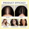 Hair Growth Spray, Hair Growth Oil Spray, Reduces Hair Loss, Hydrates And Has A Silky Texture. Suitable For Both Men And Women,50ml