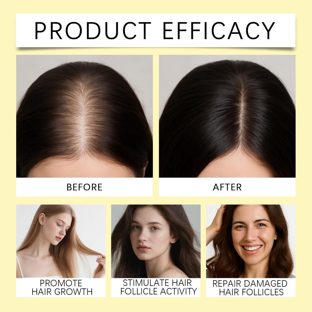 Hair Growth Spray, Hair Growth Oil Spray, Reduces Hair Loss, Hydrates And Has A Silky Texture. Suitable For Both Men And Women,50ml