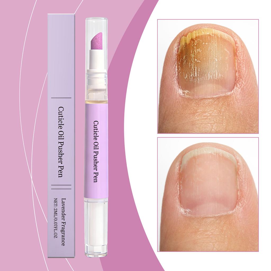 Olejové pero na péči o nehtovou kůžičku pro výživu a hydrataci povrchu nehtu, Denní péče, Přenosné pero s olejem na nehty pro aplikaci 2 ml