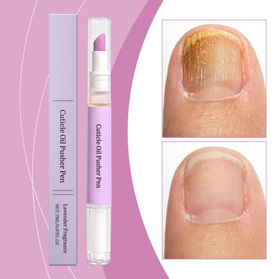 Caneta de Óleo para Cuidado da Cutícula das Unhas Para Nutrir e Hidratar a Superfície da Unha, Cuidado Diário, Caneta de Óleo de Unha Portátil Para Aplicação 2ml