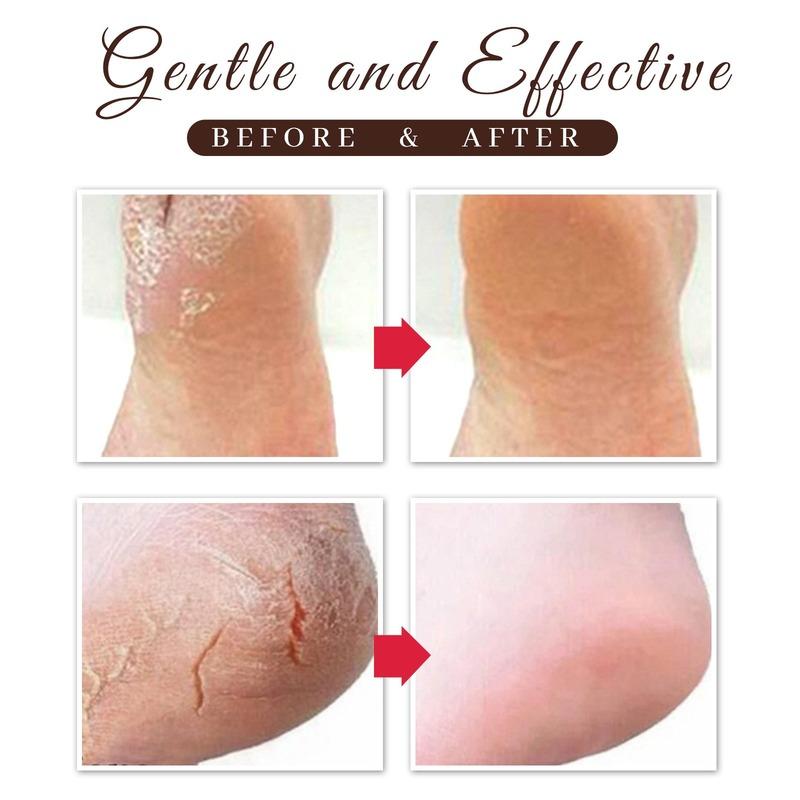 Equine Oil Foot Repair Cream Dry and Cracked Feet, Peeling, Nourishing, Moisturizing, Repairing and Anti Cracking Cream