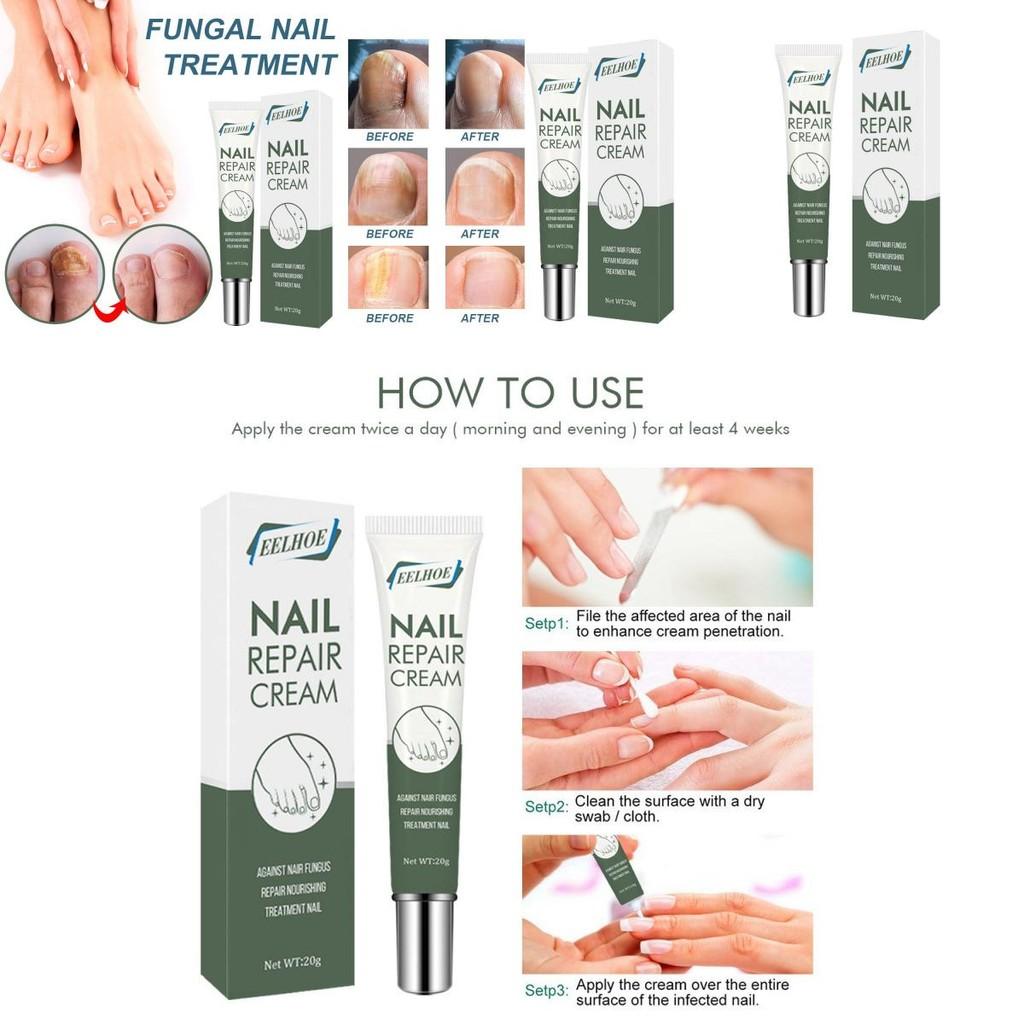 Crème de Réparation pour Ongles pour des Ongles Sains et Forts et Soin Doux des Pieds 20g Pour le Traitement des Ongles Endommagés