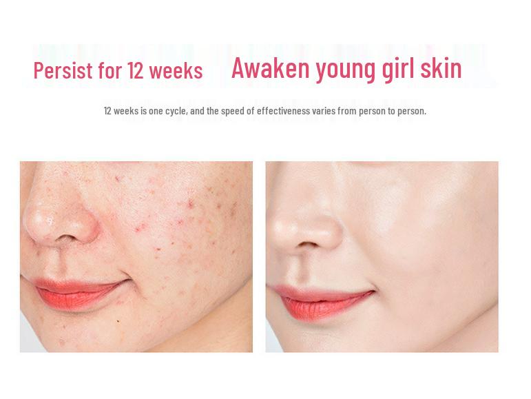 EMS Microcurrent Hot & Cold Facial Rejuvenation Device