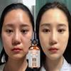 Skin Lightening Serum Strong Shades Dark Skin Anti Age .Extreme Whitening Cream for DARK Skin Face