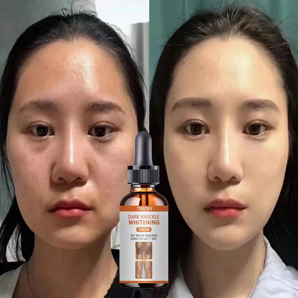 Vitamin C Serum for Face Whitening Facial Serum