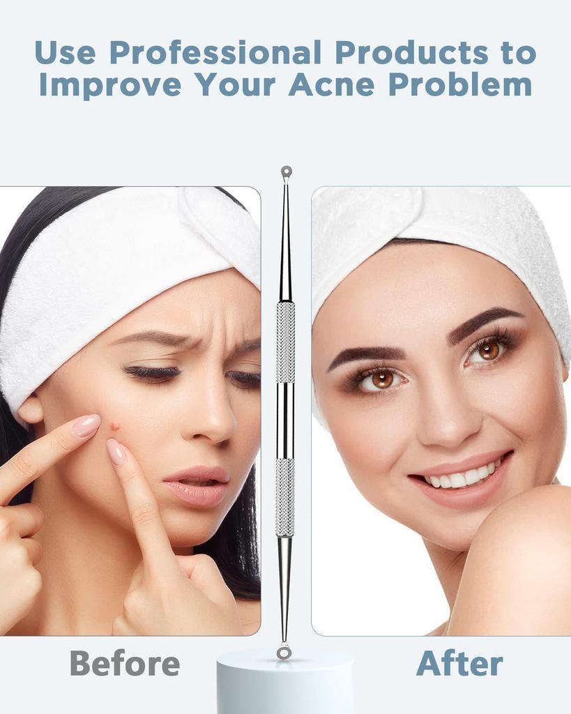 Set de 5 piese pentru îndepărtarea punctelor negre, cu capete duble, din oțel inoxidabil, negru