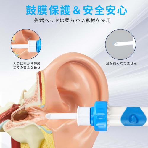 [2025 New Edition] Electric Earpick with Vibration and Suction, Ear Cleaning, Earwax Removal Kit, Ear Cleaner with Storage Case, Japanese Instruction