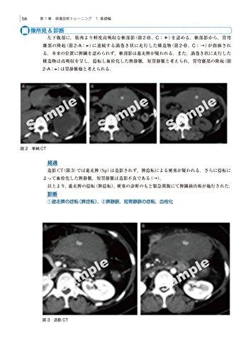 Imaging Diagnosis for Diseases and Pathology: Abdominal Emergency Diseases (Otsu Imaging Conference)