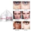 Facial Freckle Cream Targets Black Spots and Irregular Pigmentation To Reduce Black Spots  Skin Whitening, Moisturizing